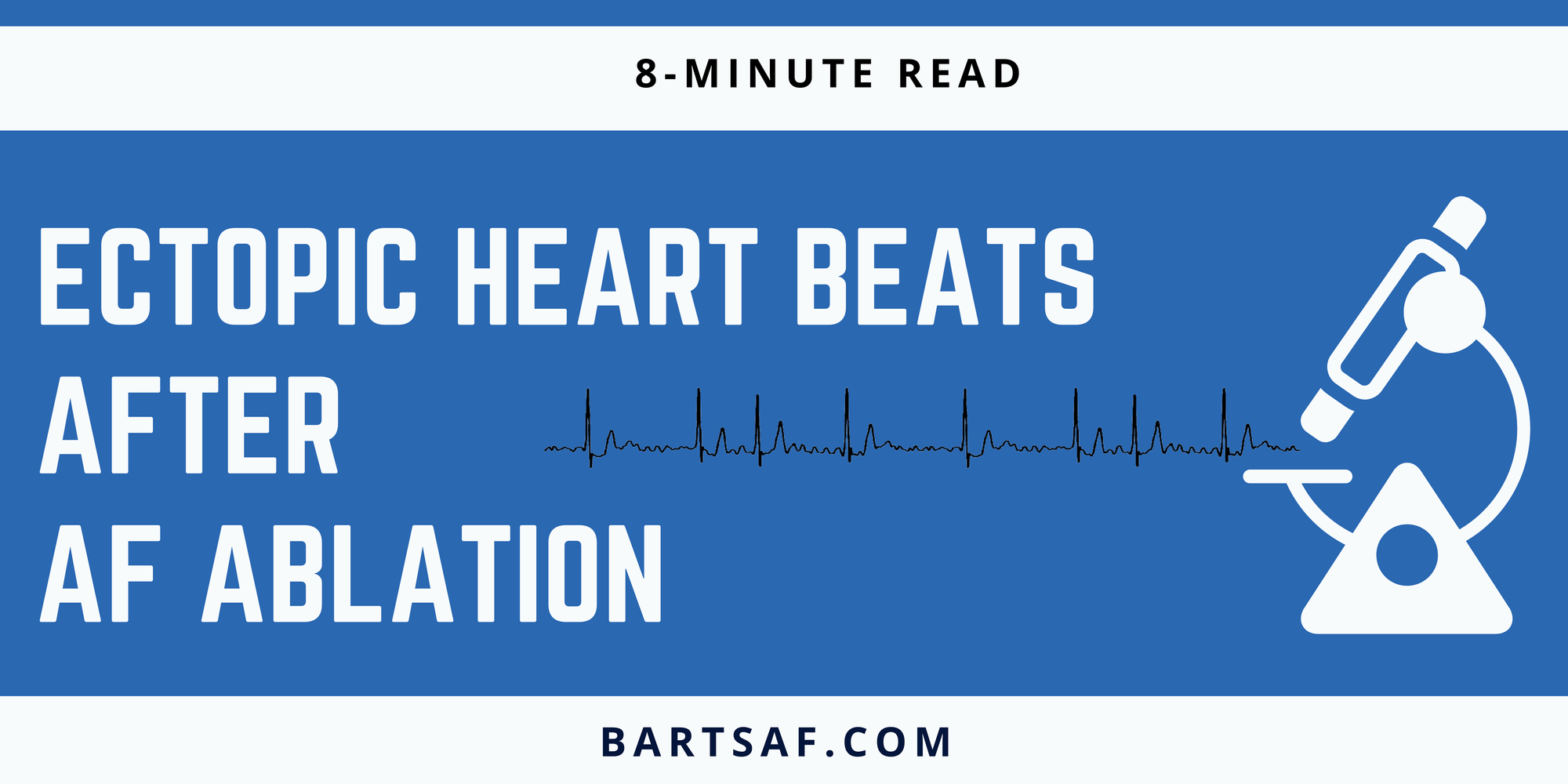 Extra heart beats after ablation