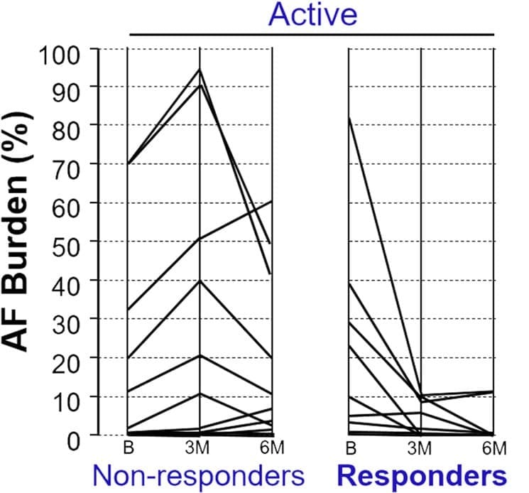 Ear stimulation: A new approach to AFib treatment